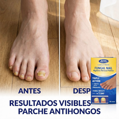 Parche Anti Hongo Uña 🦶🥺