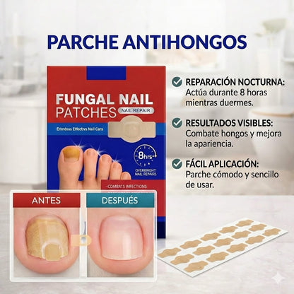 Parche Anti Hongo Uña 🦶🥺